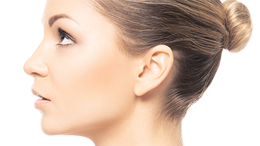 Before and after galleries of rhinoplasty procedures