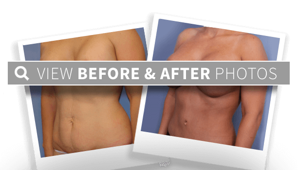 an example of our before and after results