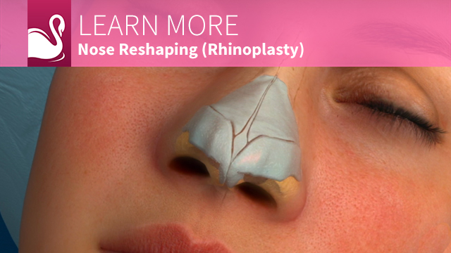 Nose Surgery - Rhinoplasty - Ocala Plastic Surgery