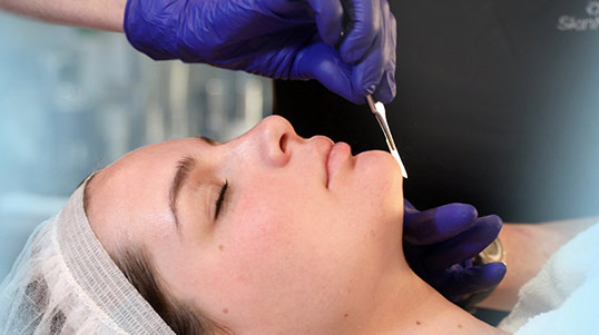 A relaxed patient receives a dermaplaning treatment.