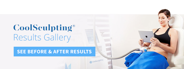 View Before and After Results Galleries for Coolsculpting
