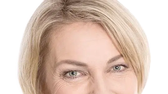 Procedures brow lift