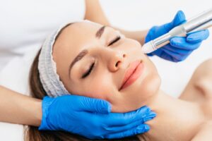 Woman smiling while receiving a gentle micro-needling treatment for skin rejuvenation.