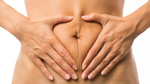 Close-up of a woman squeezing her excess belly skin after giving birth, in need of a mommy makeover treatment.